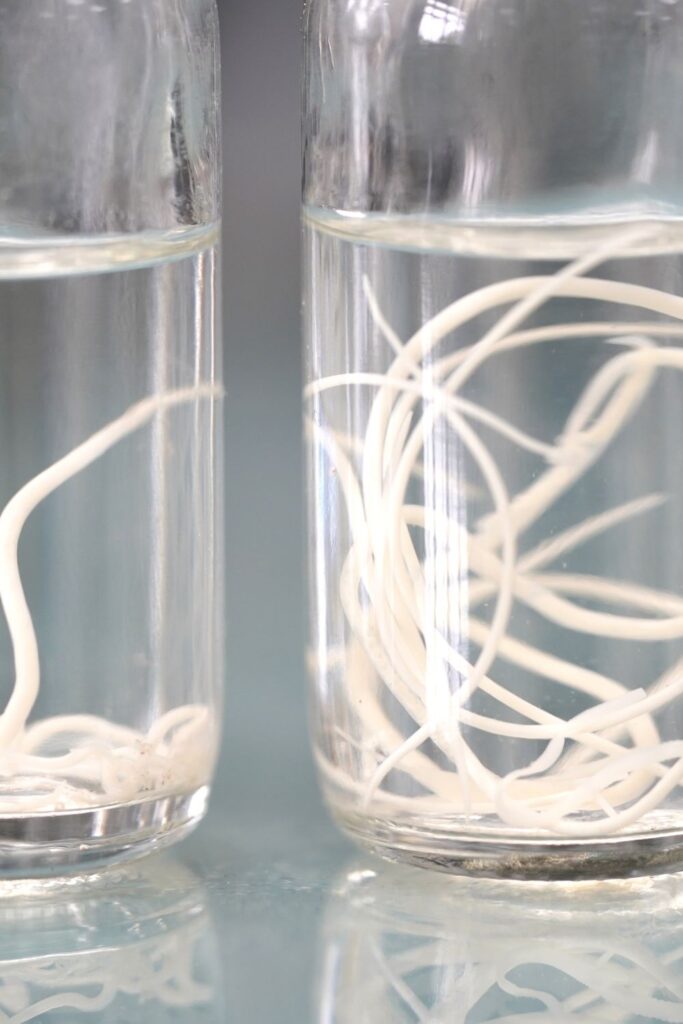 Hast du Darm Parasiten?