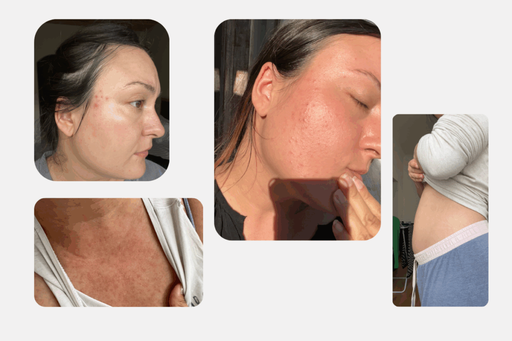 Darmgesund ins neue Jahr